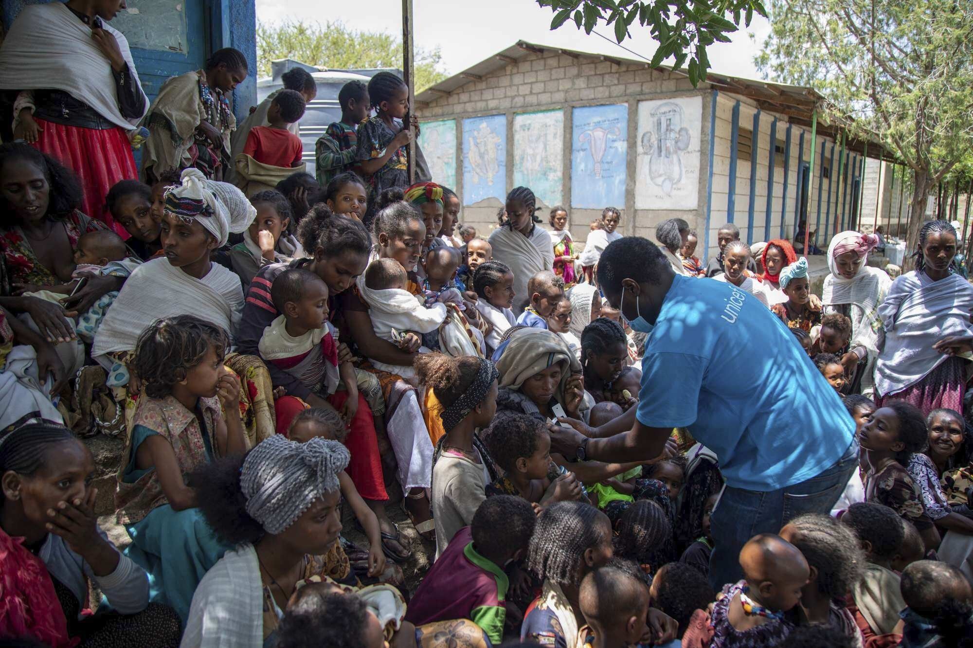 UNICEF nutrition specialist Joseph Senesie screens children for malnutrition in Adikeh, the Wajirat district of the Tigray region, northern Ethiopia, July 19, 2021. (AP Photo)