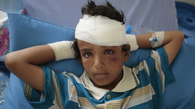 FILE - In this Aug. 12, 2018 file, photo, a child who was injured in a deadly Saudi-led coalition airstrike rests in a hospital in Saada, Yemen. The United Nations said Tuesday, Oct. 19, 2021 that more than 10,000 children in Yemen have now been killed or injured in violence linked to years of war in the impoverished country. The children???s agency UNICEF said the verified tally is surely an undercount of the real toll. (AP Photo/Hani Mohammed, File)