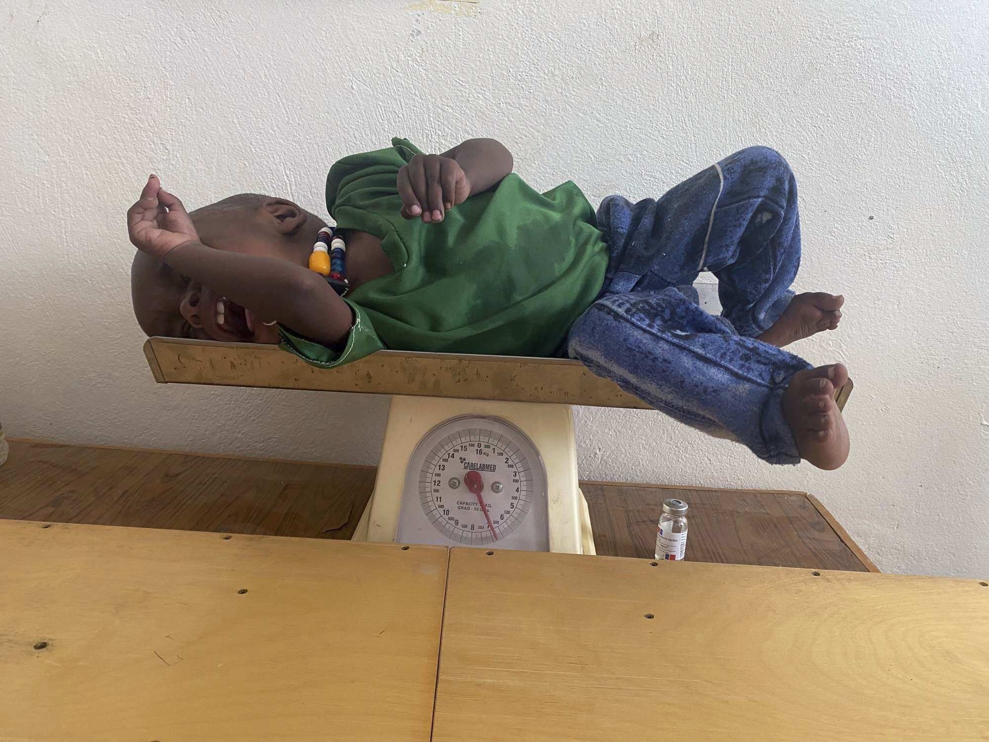 Amanuel Berhanu is weighed after being identified as severely malnourished, in the Wajirat district of the Tigray region, northern Ethiopia, July 19, 2021. (AP Photo)